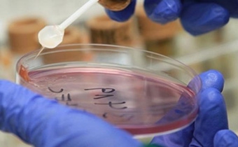 У Європі зареєстровані нові спалахи захворювання тварин викликаного вірусом Шмалленберг
