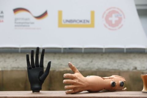 У Львові відкрили мобільну майстерню протезування